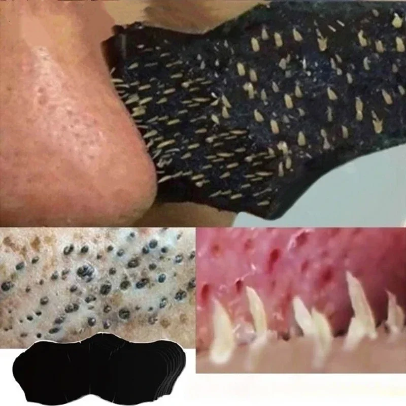 Skincare Routine - Unisex Blackhead Remove Mask Nasal Strips