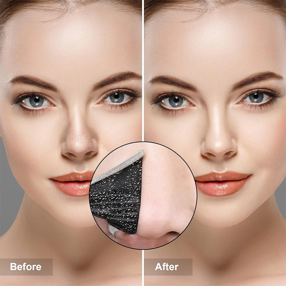 10PCS Unisex Blackhead Remove  - đánh giá và giá Skincare Viral Tiktok