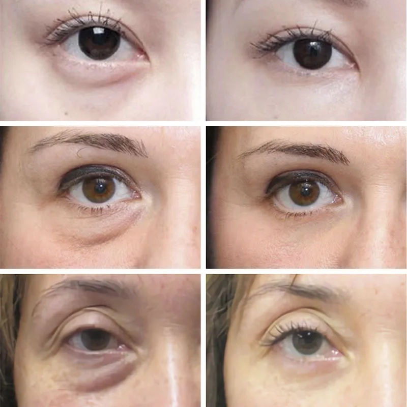 Anti Wrinkle Anti Dark Circle  - đánh giá và giá Skincare D'Alba