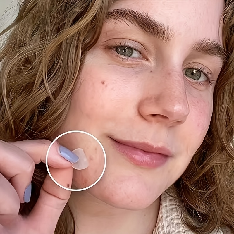 Skin-Calming Acne Patches - Hy - đánh giá và giá Hydrocolloid Acne Patch