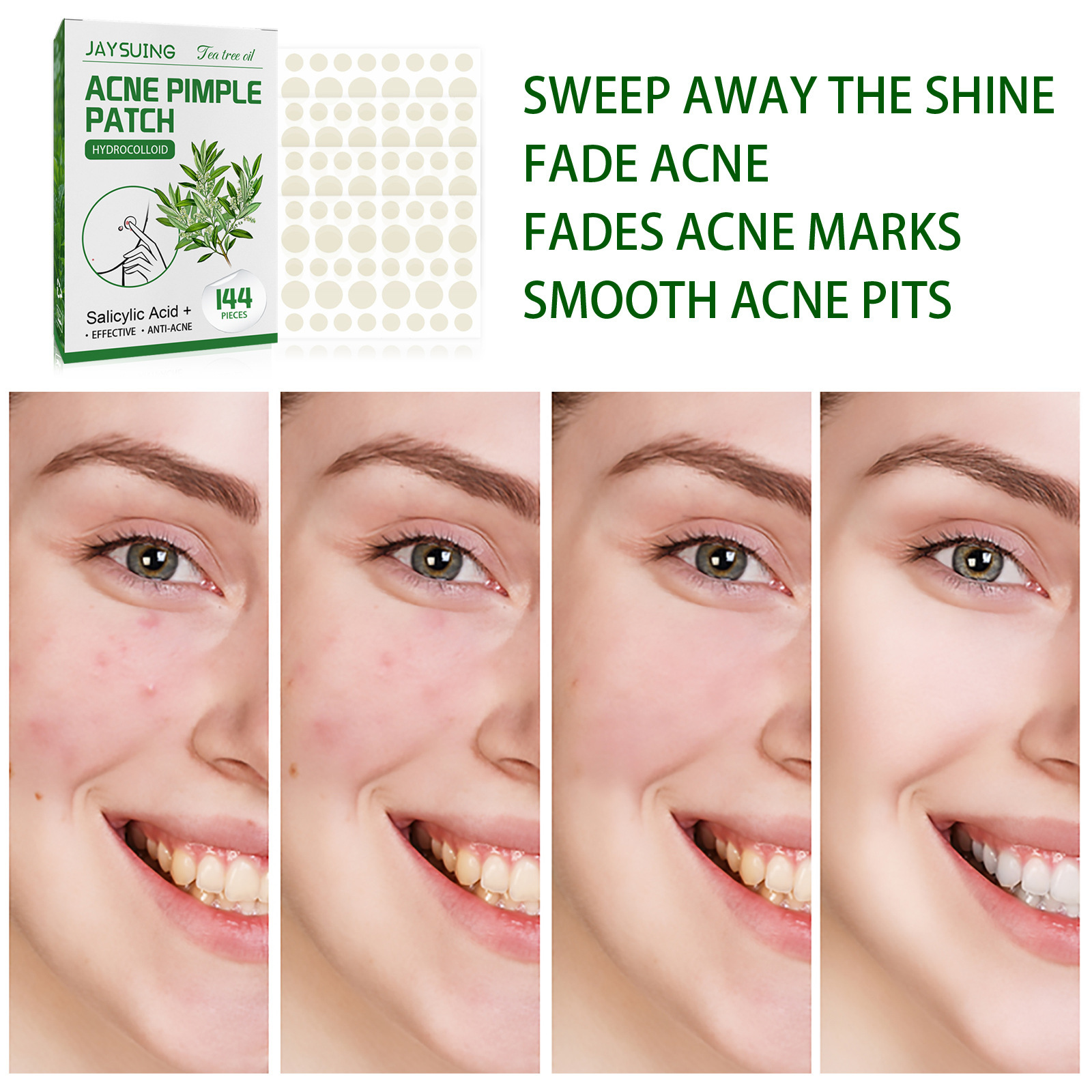 Hydrocolloid Acne Patches - Ab - đánh giá và giá Hydrocolloid Acne Patch
