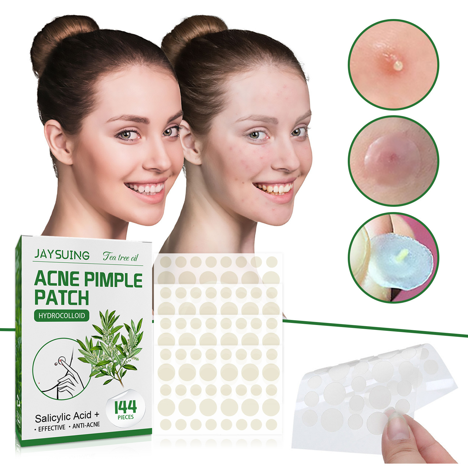 Hydrocolloid Acne Patches - Ab - đánh giá và giá Hydrocolloid Acne Patch