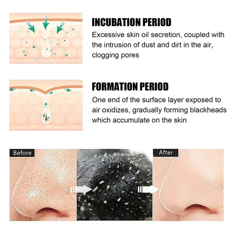 10/150PCS Blackhead Remove Mas - đánh giá và giá Skincare Viral Tiktok