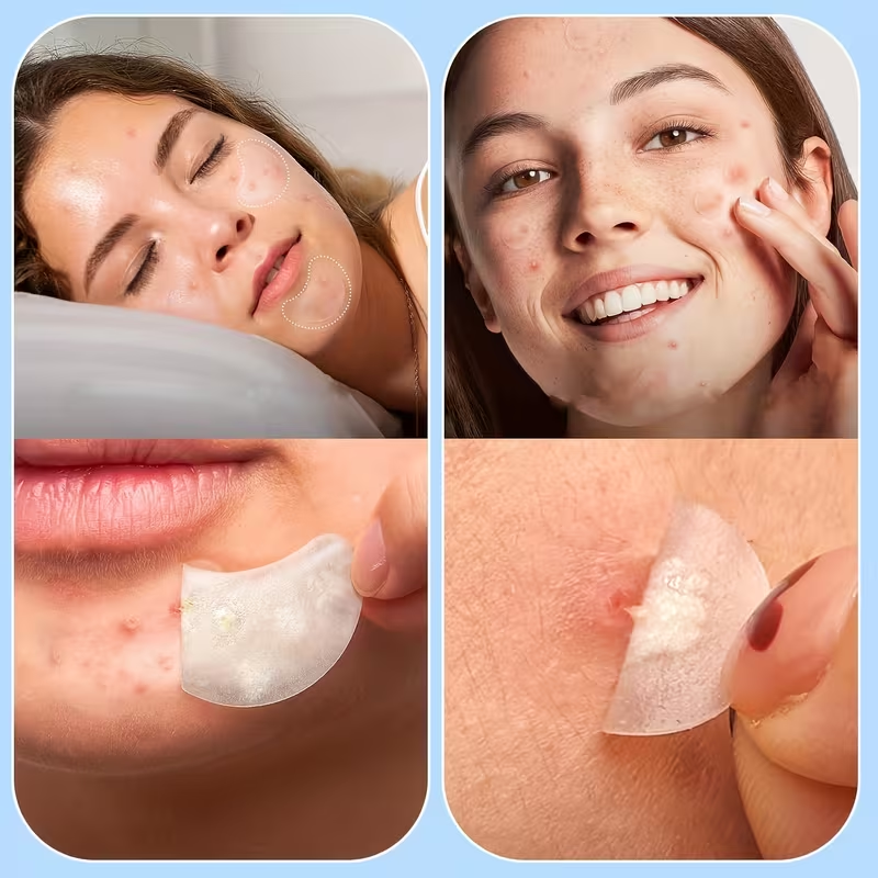 Large Pimple Patches for Face, - đánh giá và giá Hydrocolloid Acne Patch
