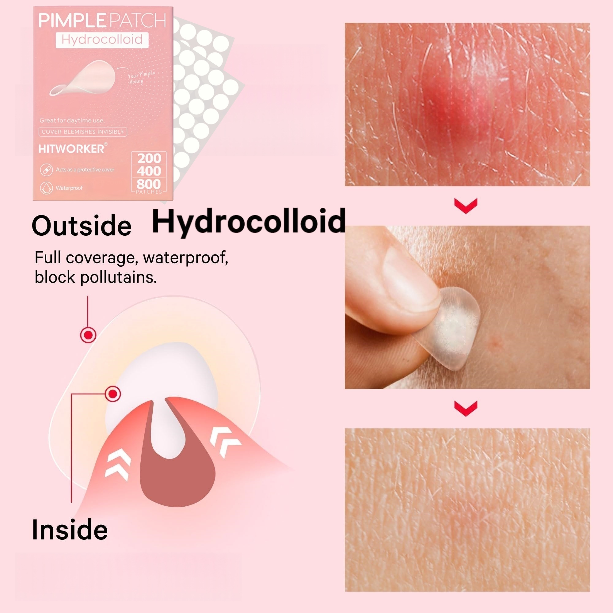 200/400/800 Pieces HITWORKER H - đánh giá và giá Hydrocolloid Acne Patch